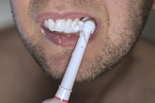9 Benefits You Can Get From Teeth Whitening